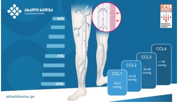 როგორ უნდა მოვუაროთ კომპრესიულ ტრიკოტაჟს?